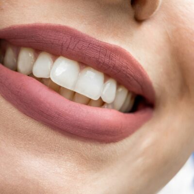 How Modern Dentistry Helps You Smile With Confidence